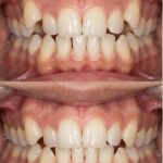 Trước điều trị