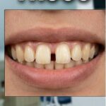 Trước điều trị