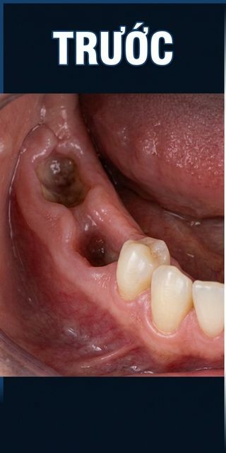 Trước điều trị – Nha Khoa Limia